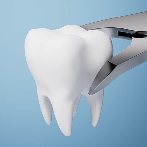 chirurgiczne usuwanie zębów Wrocław