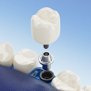 lek. dent. Kacper Bębenek - Dentysta Wrocław