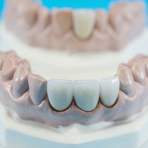 korony i mosty Wrocław korony i mosty Wrocław