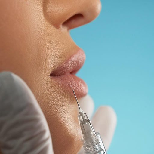 modelowanie ust Wrocław