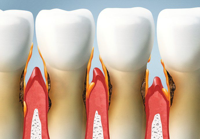 Periodontologia Wrocław